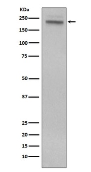 CD45 PTPRC Rabbit Monoclonal Antibody