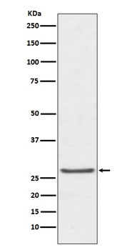 TIMP1 Rabbit Monoclonal Antibody