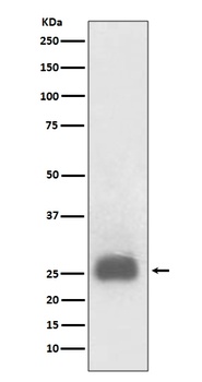 TIMP1 Rabbit Monoclonal Antibody