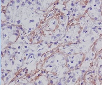 Fibronectin FN1 Rabbit Monoclonal Antibody