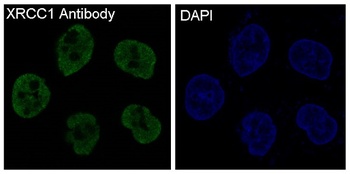 Anti-XRCC1 Rabbit Monoclonal Antibody