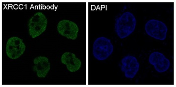 XRCC1 Rabbit Monoclonal Antibody