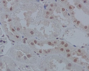 Anti-IRF1 Rabbit Monoclonal Antibody