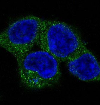 Anti-ULK1/Atg1 Rabbit Monoclonal Antibody