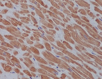 ULK1/Atg1 Rabbit Monoclonal Antibody