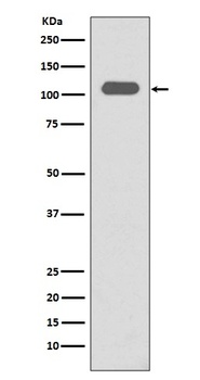 Anti-Integrin beta 3 ITGB3 Rabbit Monoclonal Antibody