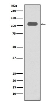 Integrin beta 3 ITGB3 Rabbit Monoclonal Antibody