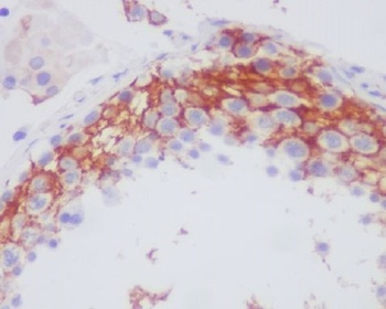 Integrin beta 3 ITGB3 Rabbit Monoclonal Antibody