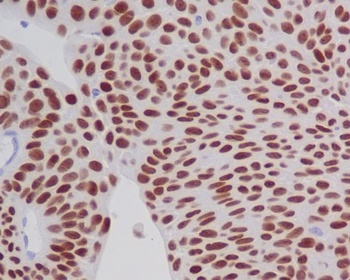 GATA3 Rabbit Monoclonal Antibody