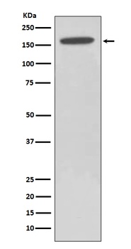 HDAC6/Histone Deacetylase 6 Rabbit Monoclonal Antibody