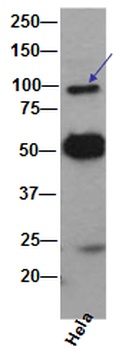 VCP Rabbit Monoclonal Antibody