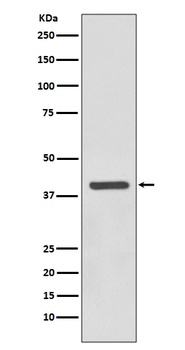 SIRT6 Rabbit Monoclonal Antibody
