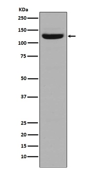 Collagen I COL1A1 Rabbit Monoclonal Antibody