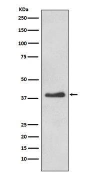 Anti-DKK1 Rabbit Monoclonal Antibody