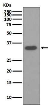 Osteopontin SPP1 Rabbit Monoclonal Antibody