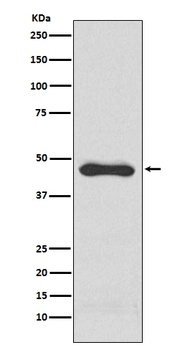 PAI1 Rabbit Monoclonal Antibody