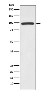 HMGCR/Hmg Coa Reductase Rabbit Monoclonal Antibody