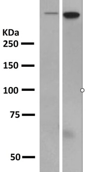 DNA-PKcs PRKDC Rabbit Monoclonal Antibody