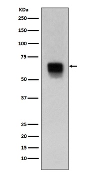 MMP14/Mt1 Mmp Rabbit Monoclonal Antibody