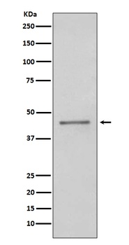 PAX5/Bsap Rabbit Monoclonal Antibody