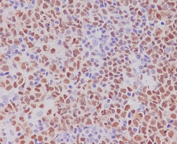 Anti-PAX5/Bsap Rabbit Monoclonal Antibody