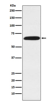 DDX5 Monoclonal Antibody