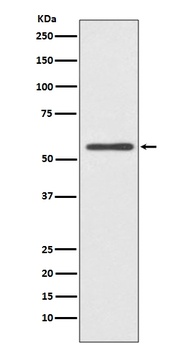 CYP2E1 Rabbit Monoclonal Antibody