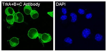 Anti-TrkA+B+C NTRK1 Rabbit Monoclonal Antibody