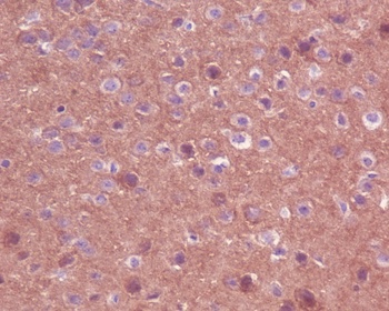 Anti-TrkA+B+C NTRK1 Rabbit Monoclonal Antibody