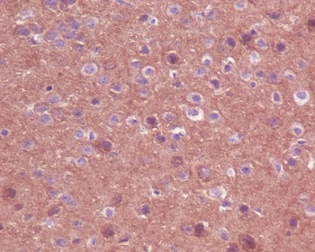 TrkA+B+C NTRK1 Rabbit Monoclonal Antibody