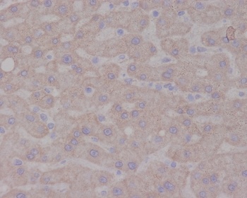 TrkA NTRK1 Rabbit Monoclonal Antibody