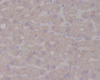 Anti-TrkA NTRK1 Rabbit Monoclonal Antibody