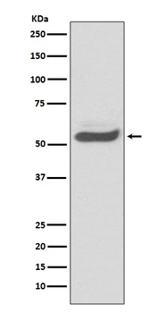 SERPINA1/Alpha 1 Antitrypsin Rabbit Monoclonal Antibody