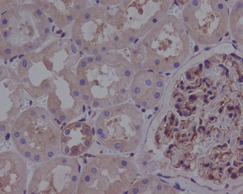 Anti-ROCK1 Rabbit Monoclonal Antibody