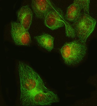 Anti-FOXP1 Rabbit Monoclonal Antibody