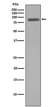 Anti-p95/NBS1 NBN Rabbit Monoclonal Antibody
