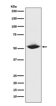 MMP1 Rabbit Monoclonal Antibody