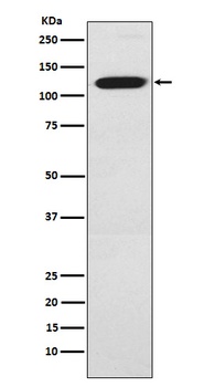 Ctip1 Rabbit Monoclonal Antibody