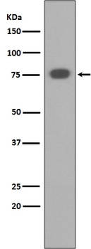 Anti-PKC alpha PRKCA Rabbit Monoclonal Antibody