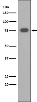 PKC alpha PRKCA Rabbit Monoclonal Antibody