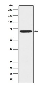 ZAP70 Rabbit Monoclonal Antibody