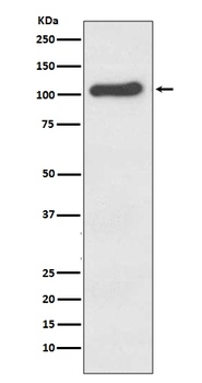 ACE2 Rabbit Monoclonal Antibody