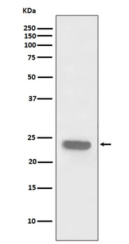 PARK7/Dj 1 Rabbit Monoclonal Antibody