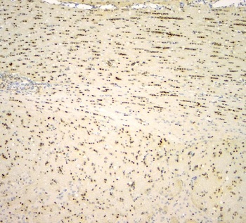 Anti-SOX10 Rabbit Monoclonal Antibody