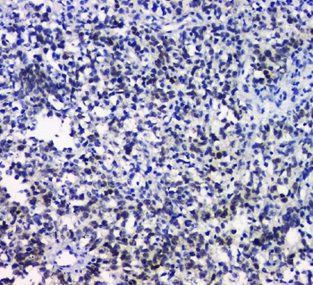 Anti-SOX10 Rabbit Monoclonal Antibody