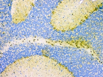 Anti-SOX10 Rabbit Monoclonal Antibody
