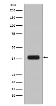 Aurora B AURKB Rabbit Monoclonal Antibody