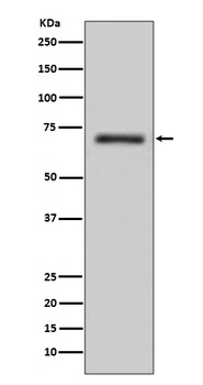 FUS / TLS Rabbit Monoclonal Antibody