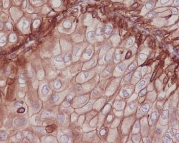 Anti-Integrin beta 1 ITGB1 Rabbit Monoclonal Antibody