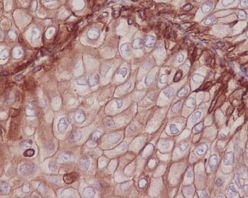 Integrin beta 1 ITGB1 Rabbit Monoclonal Antibody